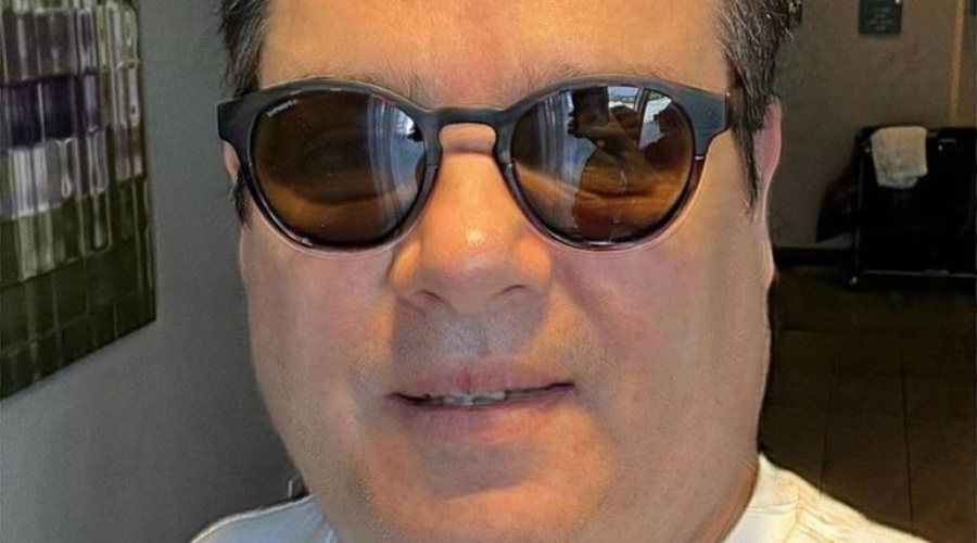 Celso Portiolli aparece com rosto inchado e brinca: 'Três dias de férias' 1