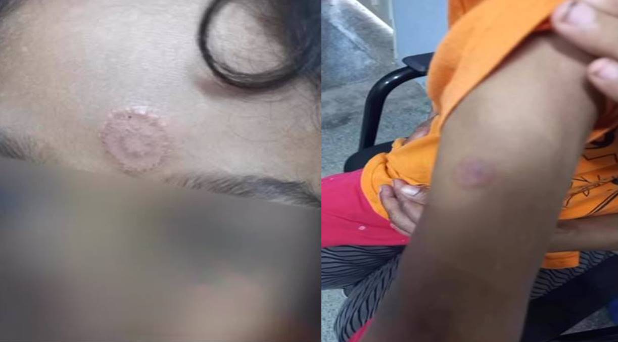 Menor faccionado é apreendido pela PM após queimar o primo com um cigarro de maconha 1