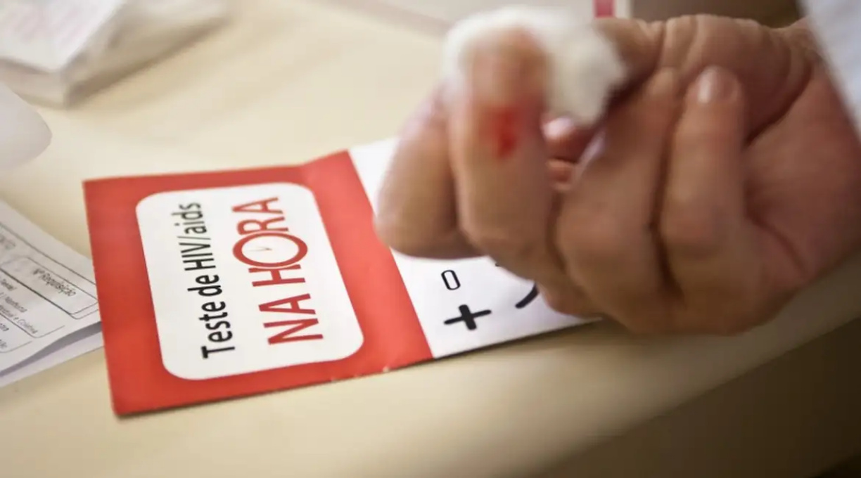 Aids: Brasil tem alta de casos, mas menor mortalidade desde 2013 1