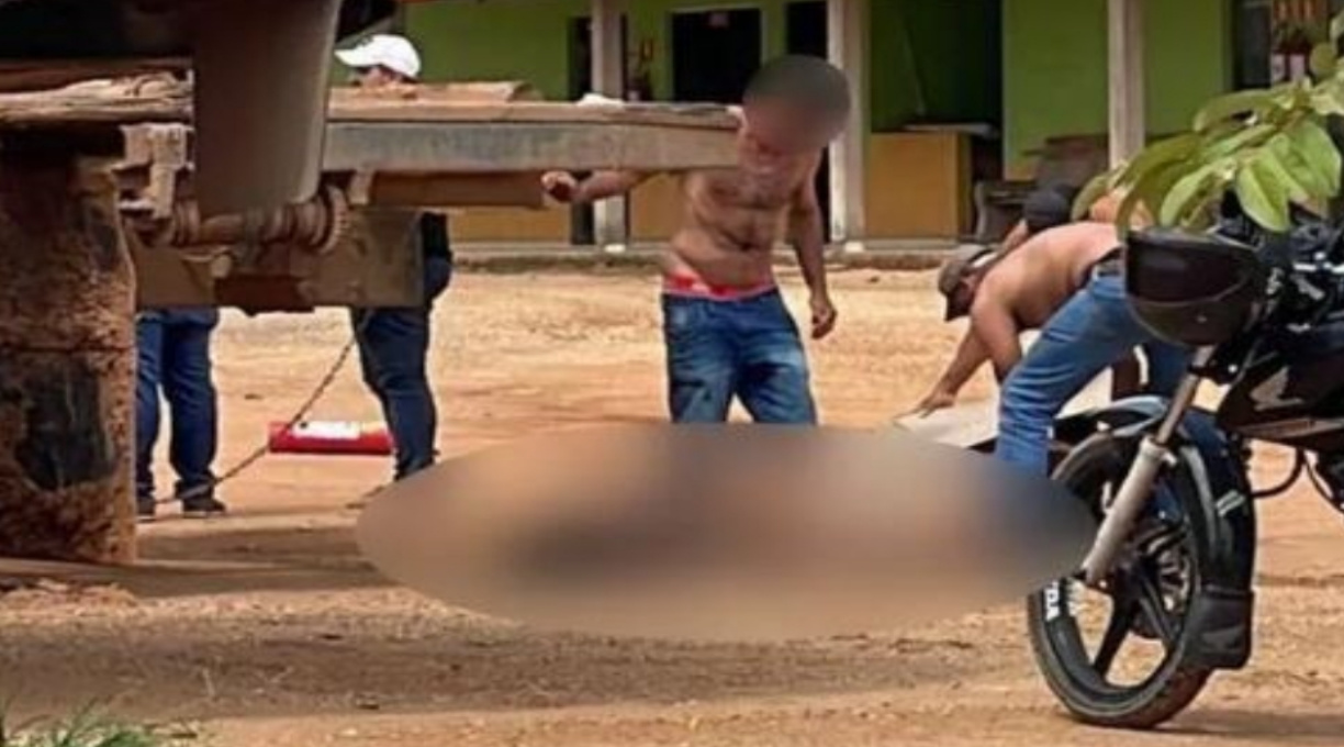 Trabalhador fica com 100% do corpo queimado após a explosão de um tanque de combustível 1