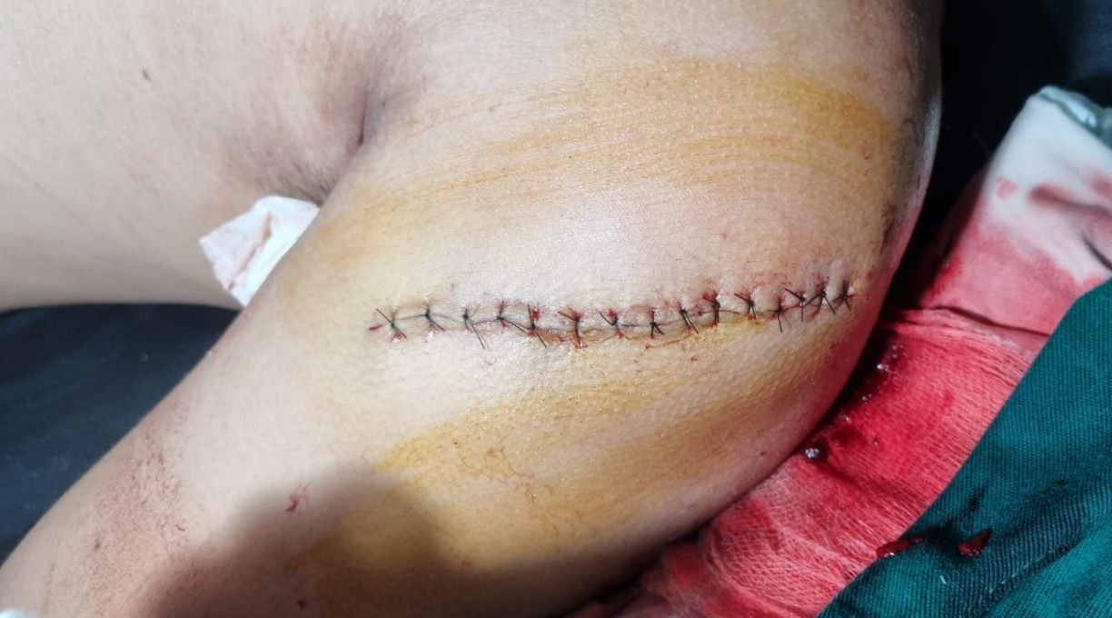 PM prende homem após esfaquear enteado e padrasto durante discussão 1