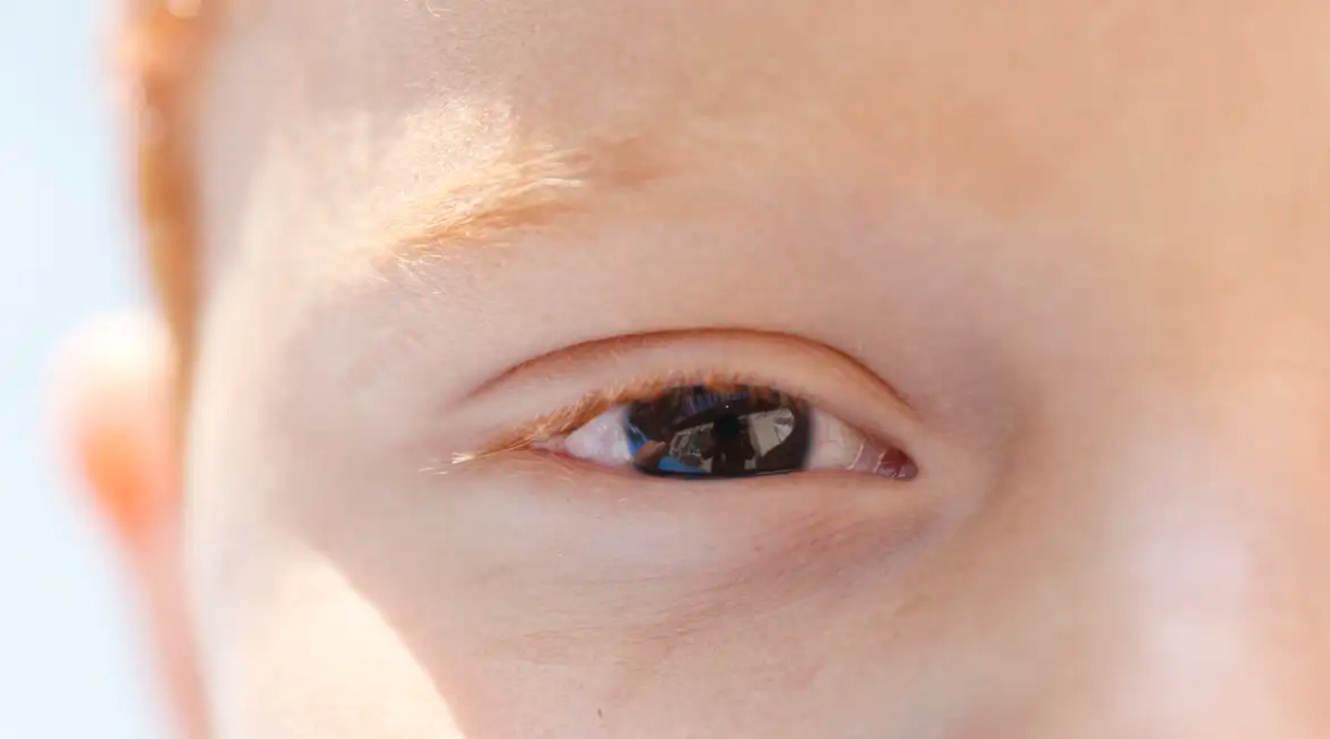 Erros de refração são principal causa de deficiência visual infantil 1