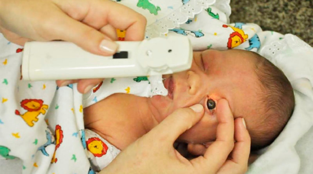 Teste do olhinho deve ser repetido três vezes ao ano até os 3 anos 1