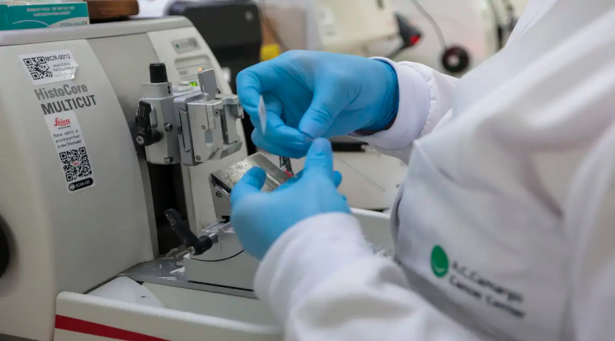 Cura de câncer de próstata pode chegar a até 98% 1