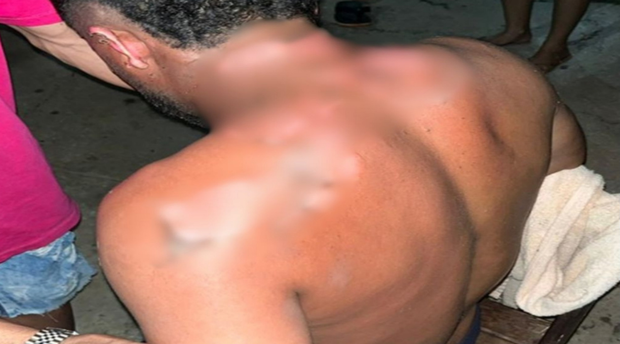 PM prende mulher suspeita de atear fogo contra o marido após discussão 1