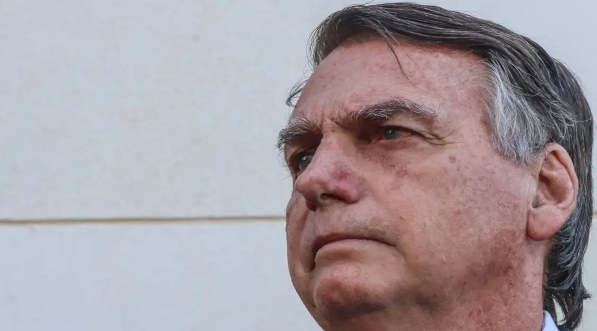 Hospital confirma que Bolsonaro está com infecção pulmonar e foi internado na UTI 1