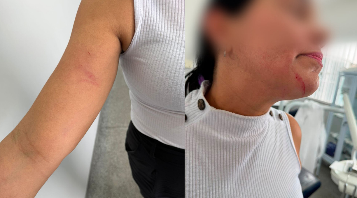 Secretaria de Saúde repudia agressões sofridas por uma auxiliar de saúde bucal na unidade de saúde do bairro Santa Clara 1