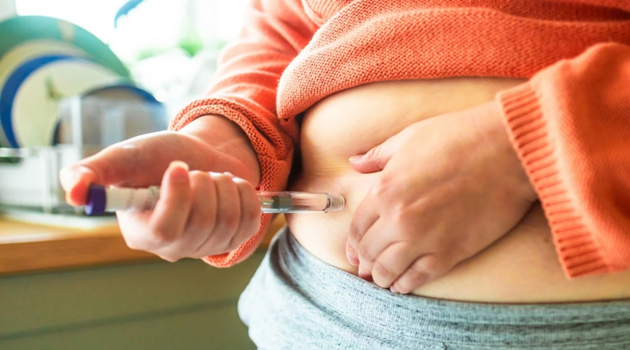 Emagreceu com caneta ou bariátrica? Você pode ter direito à cirurgia reparadora 1 Emagreceu com caneta ou bariátrica? Você pode ter direito à cirurgia reparadora 1