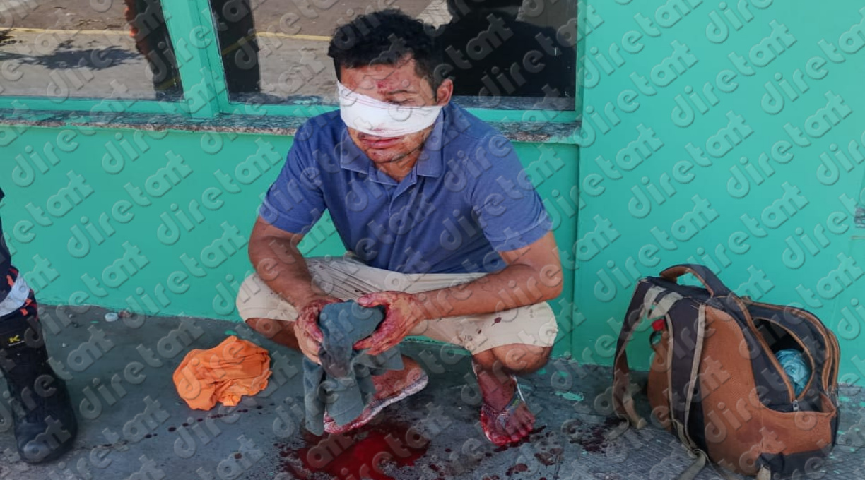 Desentendimento entre pessoas em situação de rua, no centro de Rondonópolis, resulta em homem esfaqueado no rosto 1